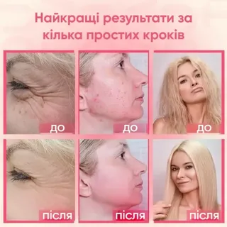 Дарсонваль для волос для лица высокочастотный массажер стимуляция кровообращения регенерация клеток 4в1, мініатюра 9